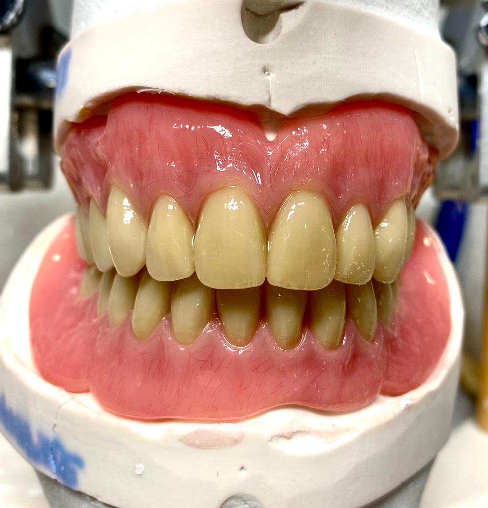 Prosthetics Dental Technician Goes Freelance!